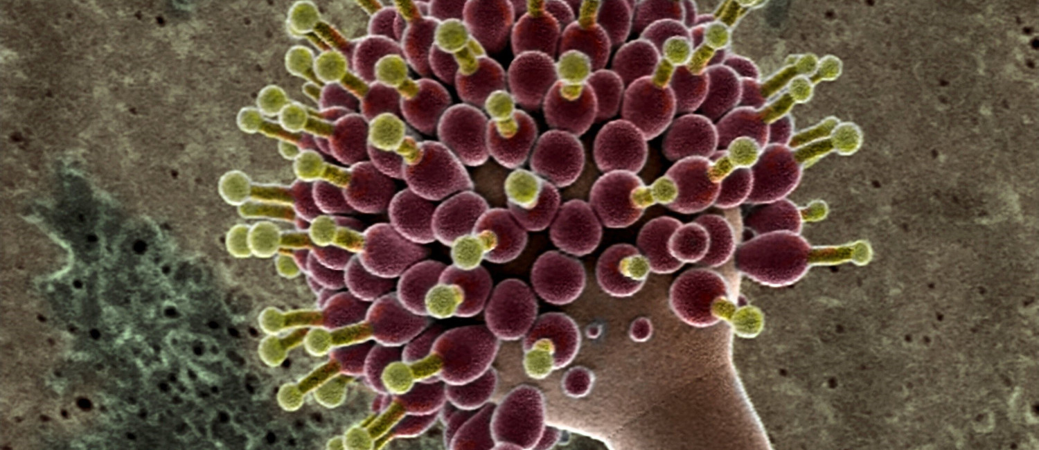 Microorganism-Example(cbs).jpg