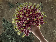 Microorganism-Example(cbs).jpg