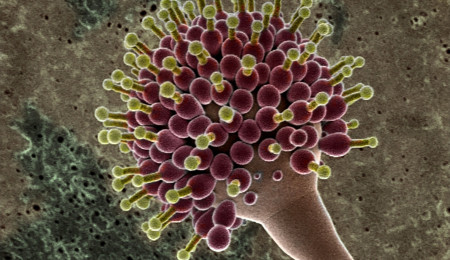 Microorganism-Example(cbs).jpg